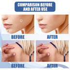 Kew Patch Gentle Cleaning Care Skin Face Neck Repair Smooth Skin Daily Care