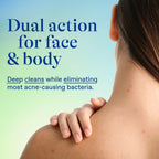 Maximum Strength Acne Foaming Cleanser Face and Body Wash with 10% Benzoyl Peroxide, Fast-Acting Acne Treatment, 5 Oz