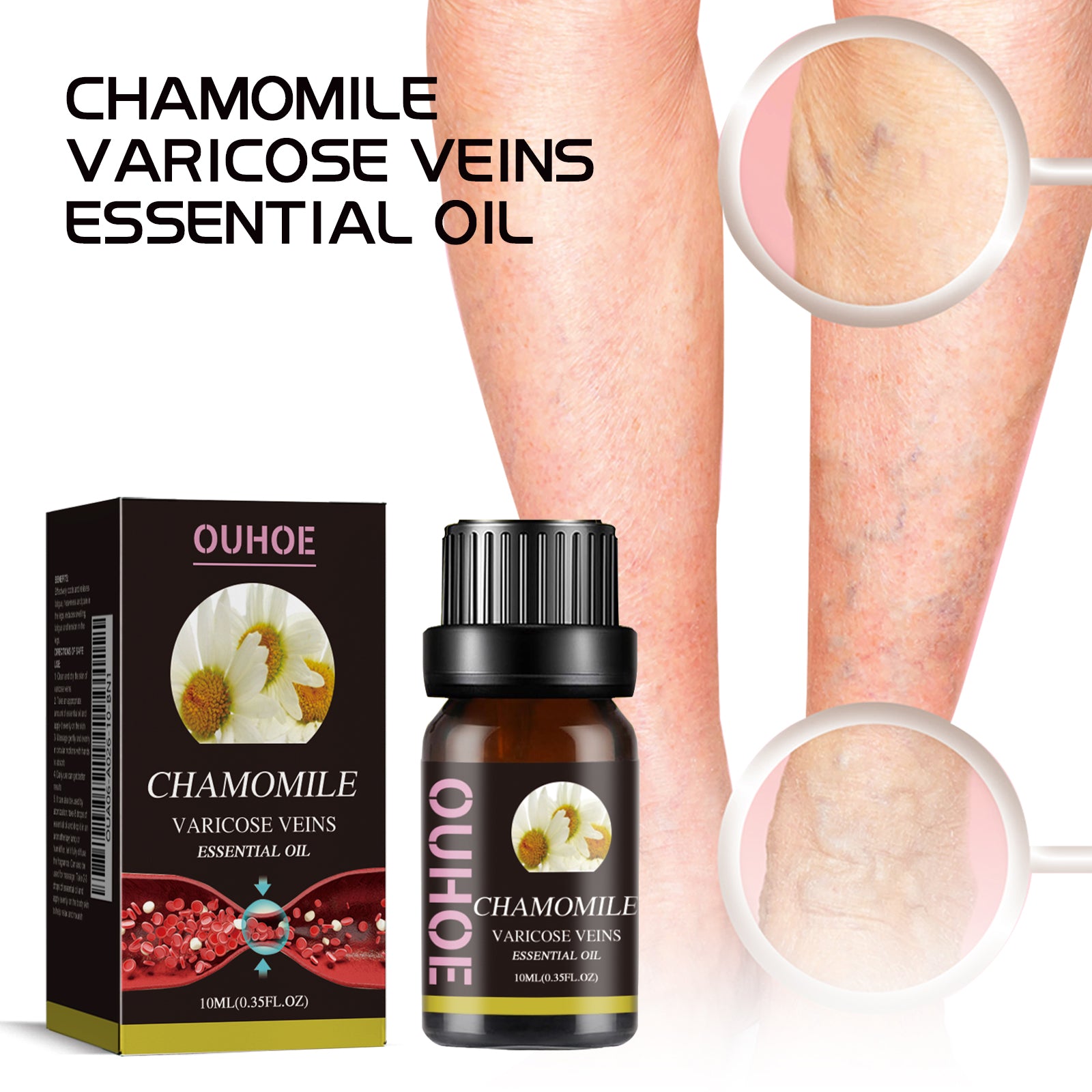 Chamomile Leg Essential Oil Protects Leg Skin And Relieves Leg Discomfort With Daily Massage Essential Oil