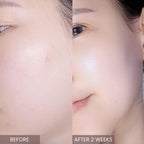 Pink Tea Tree Synergy Serum 30Ml/Skin Moisturizer/Facial Moisturizers/1.01 Fl. Oz, CICA, Hyaluronic Acid and Niacinamide, Korean Skin Care, Hydrating