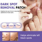 Dark Spot Removal Patch, Lightening Face Dark Spots Melasma Spots Melanin Moisturizing Whitening Skin Spot Patch