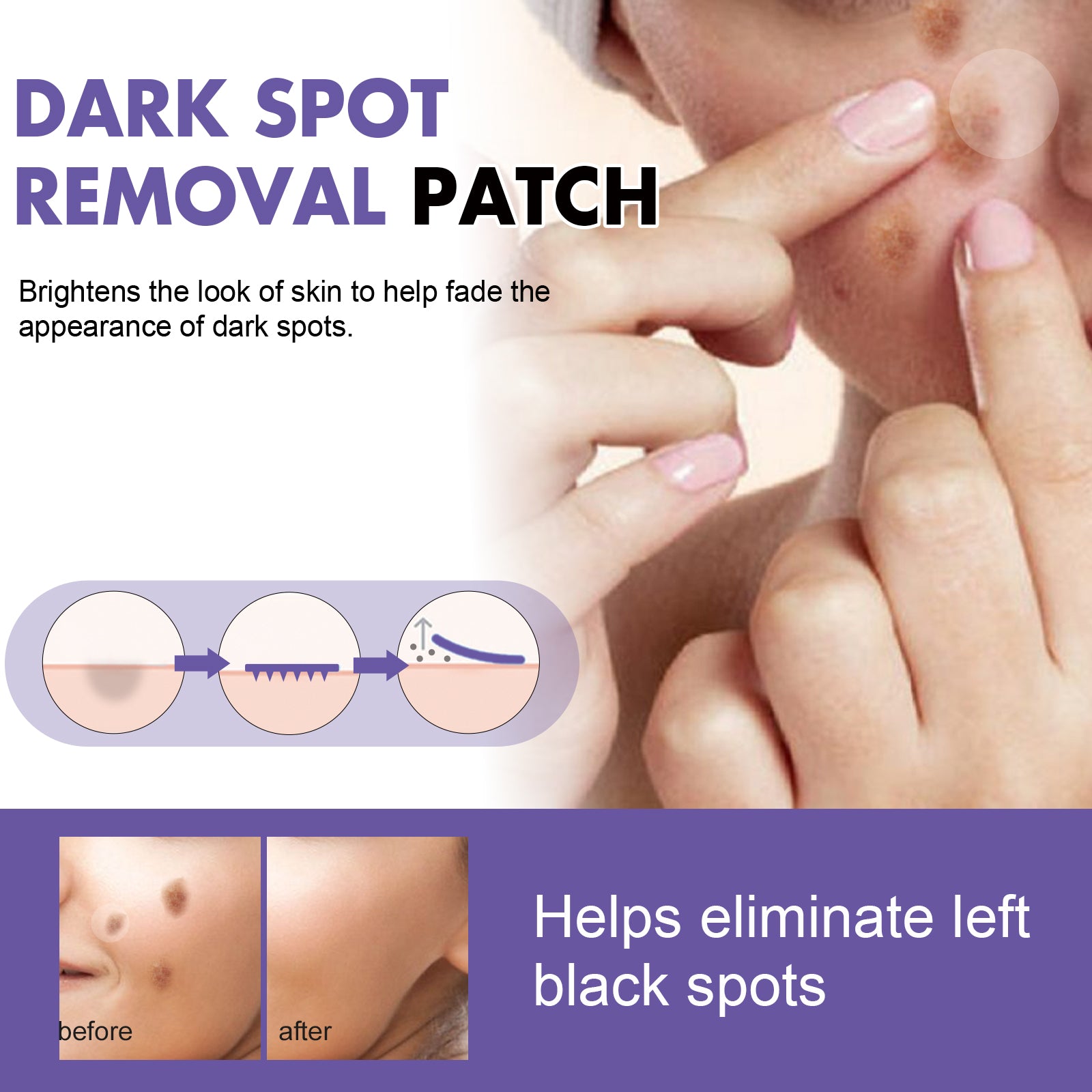 Dark Spot Removal Patch, Lightening Face Dark Spots Melasma Spots Melanin Moisturizing Whitening Skin Spot Patch