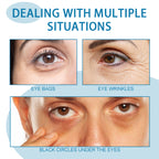 Eye Cream, Lighten The Fine Lines Of The Circles And Bags Under The Eyes Moisturizing Firming And Easy Absorption Overnight Eye Cream