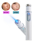Eraser Blue Light Therapy Wrinkle Acne Laser Pen Soft Scar Removal