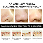 Bamboo Charcoal Blackhead Removing Tearing Facial Mask, Moisturizing Removing Blackhead And Acne Shrinking Pore Oil Control Mud Mask