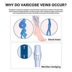 Leg Repair Cream Relieves Leg Discomfort Massage Leg Repair Cream For Raised Veins