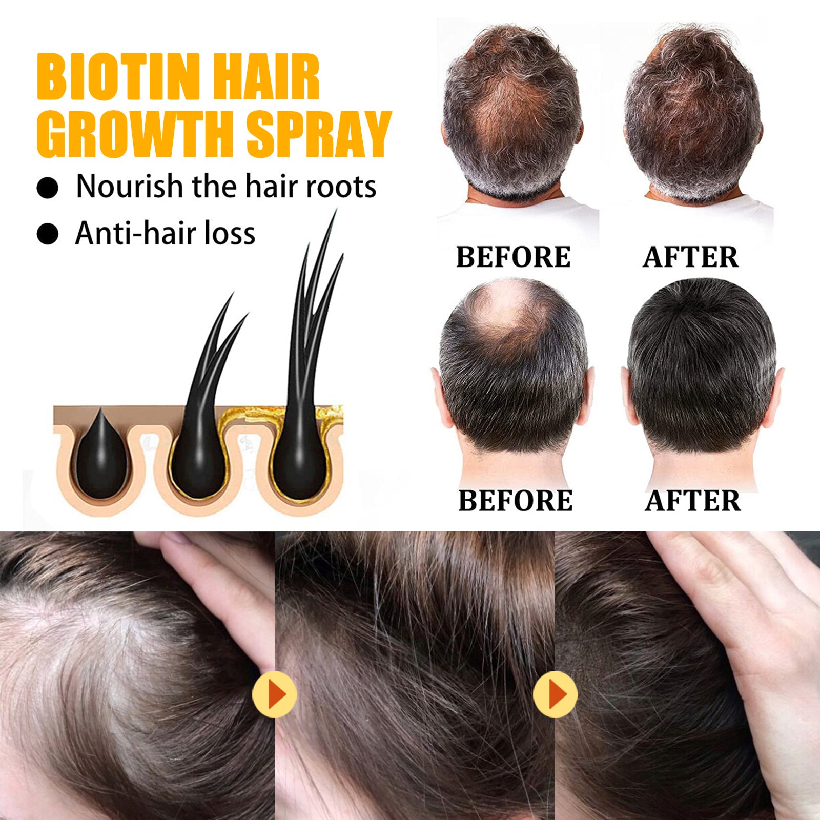 Biotin Hair Growth Spray, Strong Anti-Rip Repair Hair Care And Root Stabilization Spray