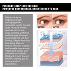 Aloe Vera Eye Gel Patch Reduces Fine Lines Under Eyes, Dark Circles Under Eyes, Firming Eyes, Anti-Wrinkle And Moisturizing Eye Patch