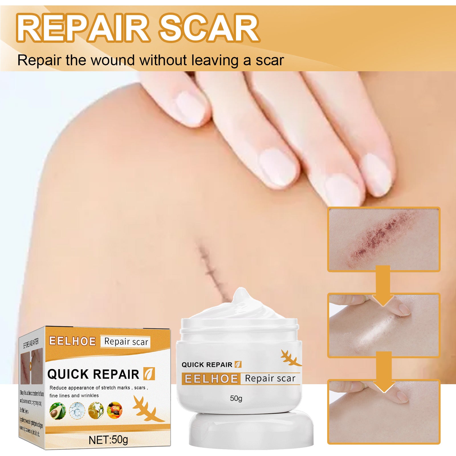 Desalting Skin Scar Cream, Skin Burn Scalding Surgical Scar Wound Repair Cream