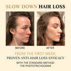 Hair Boost Darken Strengthen Essence, Scalp Massage Moisturizing Hair Roots Thick Smooth Hair Care Ball