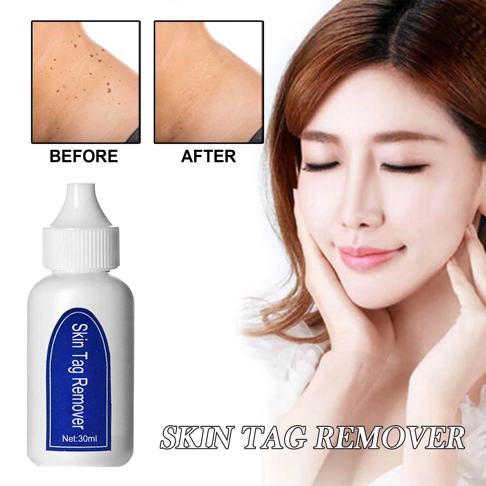 5Ml Quick Skin Blemish Spot Treatment