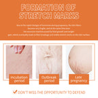 Pregnancy Massage Oil, Repair Pregnant Women Prenatal And Postpartum Stretch Mark Skin Care Massage Oil