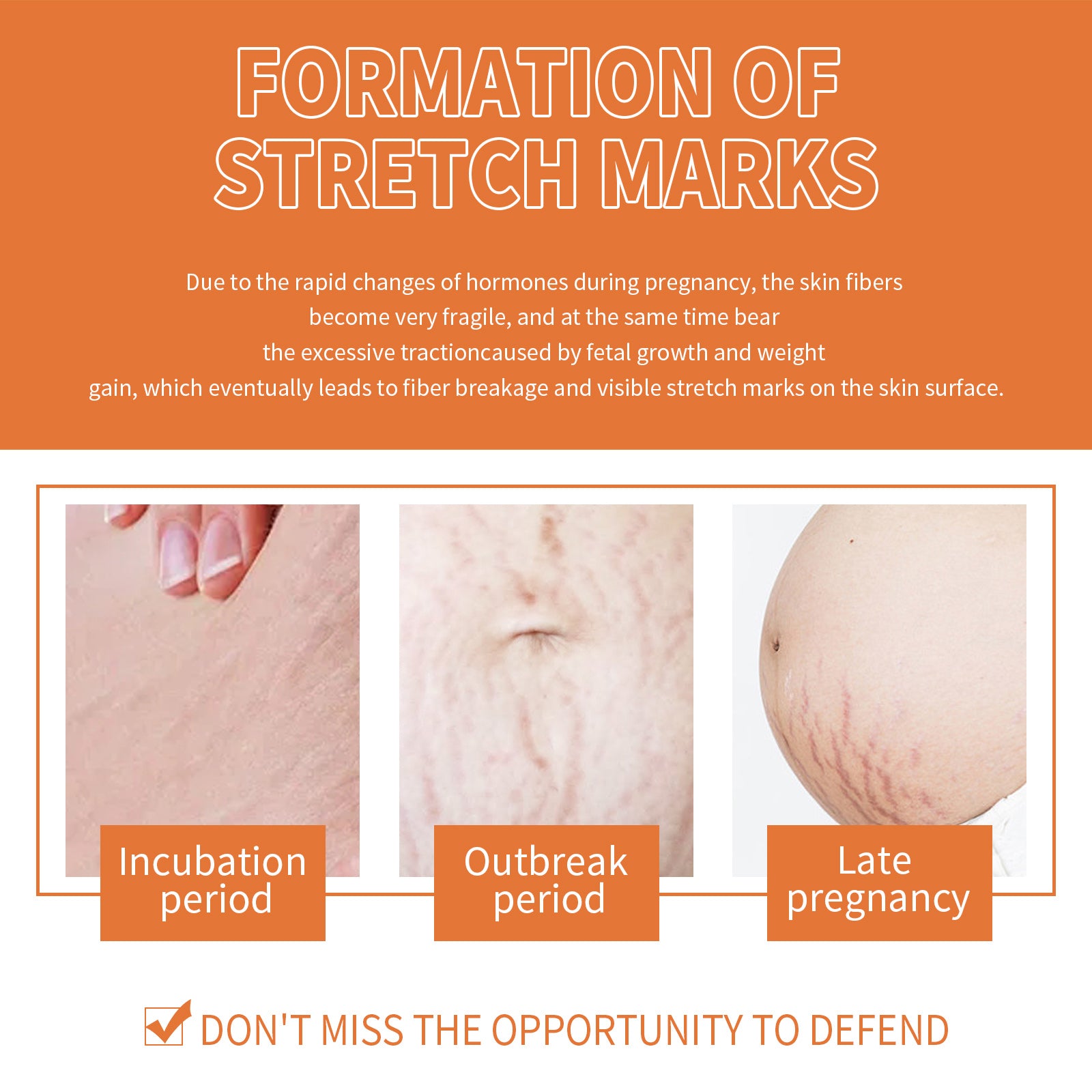 Pregnancy Massage Oil, Repair Pregnant Women Prenatal And Postpartum Stretch Mark Skin Care Massage Oil