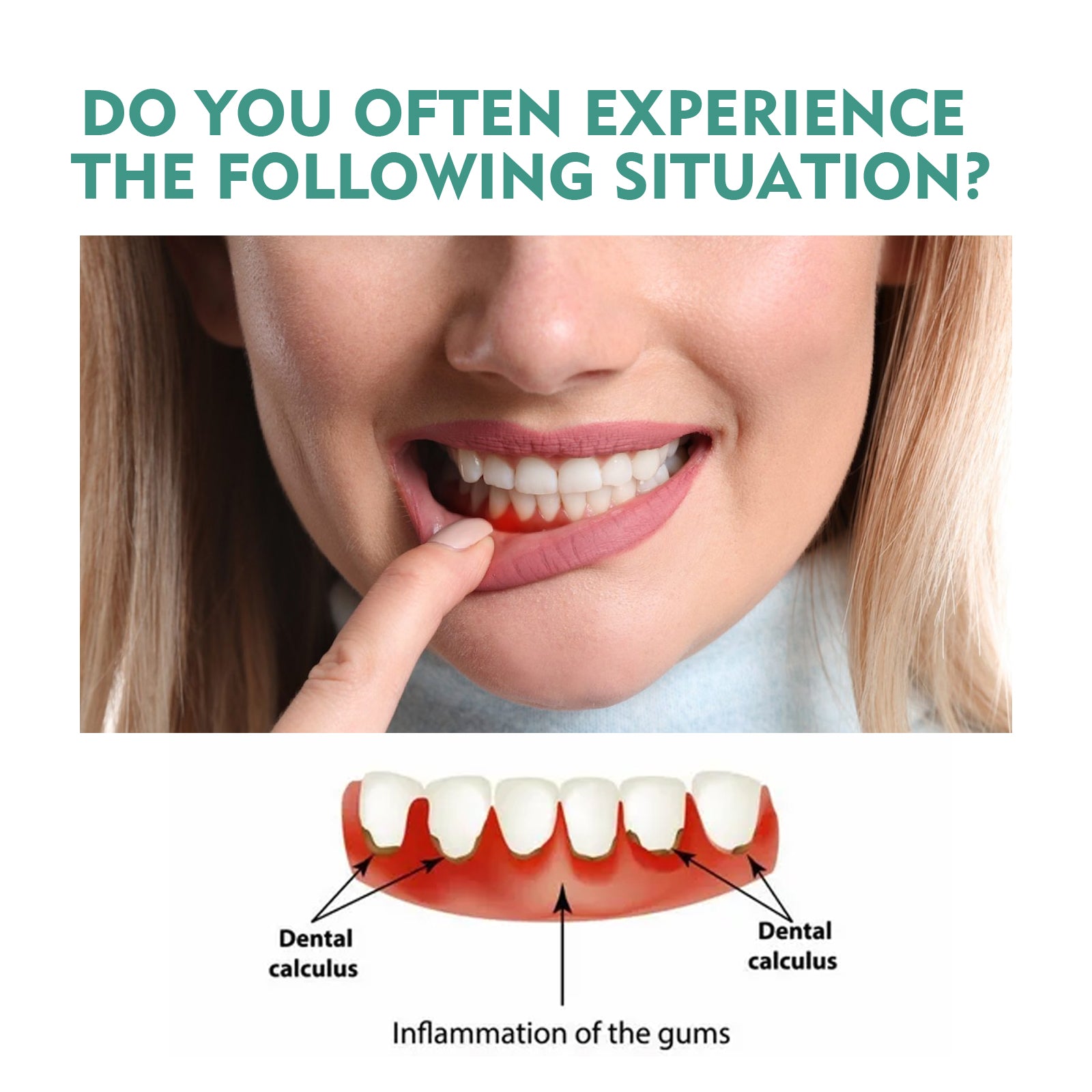 Oral Relief Spray To Relieve Aphthous Sores Bubbling Periodontal Pain Oral Care Spray