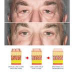 Men's Retinol Eye Cream, Gentle Nourishing Eye Skin Moisturizing And Firming Apply Eye Cream