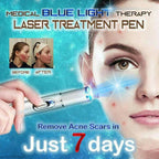 Eraser Blue Light Therapy Wrinkle Acne Laser Pen Soft Scar Removal