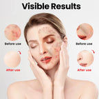 Medical Grade Professional 510K Silicone Facial Skin Led Face and Neck Red Light Therapy Mask for Skin Rejuvenation