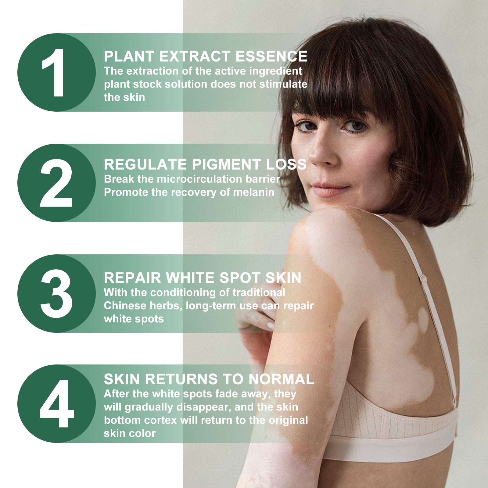 Vitiligo Relief Cream, Repair White Spots Flower Spots Skin Topical Care Ointment