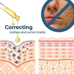 Turmeric Whitening Spot Serum, Lighten Freckle Spots Brightening Skin Hydrating Serum