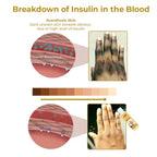 Acanthosis Nigricans Removal Oil, Exfoliating Light Black Brightening And Beauty Skin Oil