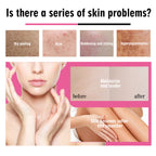 Body Care Oil Skin Dry Moisturizing Body Skin Firming Massage Essential Oil