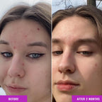 Anti-Wrinkle Nicotinamide Balance Facial Fluid