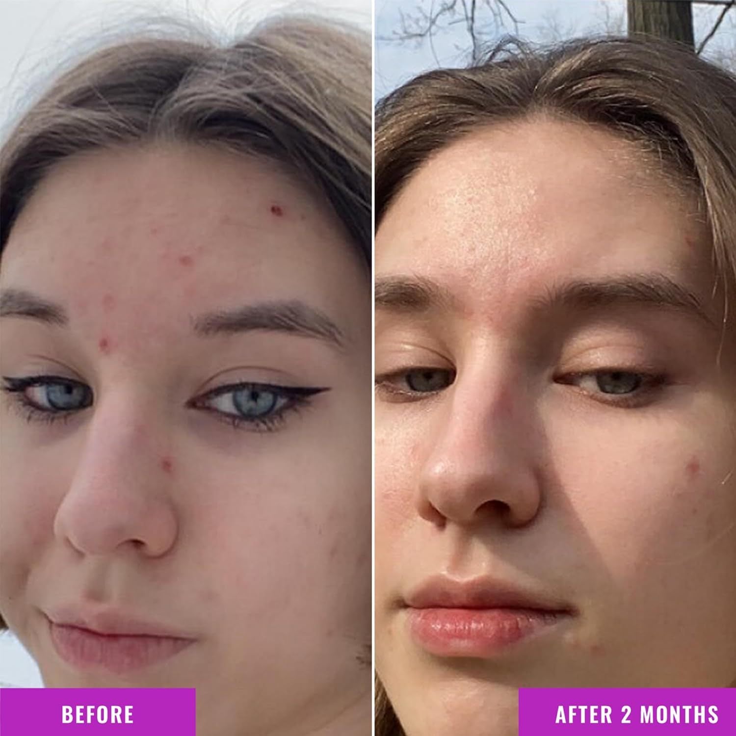 Anti-Wrinkle Nicotinamide Balance Facial Fluid