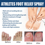 Athletes Foot Relief Spray, Relieve Foot Sweat Foot Itching Peeling Gray Nails Foot Odor Moisturizing Care Spray