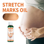 Pregnancy Massage Oil, Repair Pregnant Women Prenatal And Postpartum Stretch Mark Skin Care Massage Oil
