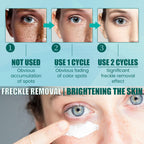 Facial Care Cream Facial Skin Moisturizing And Hydrating Spot Repair Skin Care Cream