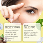 Eye Cream Eye Essence Reduces Fine Lines Under Eye Bags, Moisturizes And Improves Eye Condition, Nourishes Tenderness And Brightening