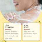 EELHOE Aloe Vera Body Wash Gel Deeply Cleaning Body Dirts Improve Skin Texture Acne Treatment Moisturizing Body Bathing Gel