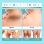 EELHOE Acanthosis Nigricans Skin Repair Set Repair Underarm Arm Knee Joint Black Moisturizing Whitening Body Skin CareCream