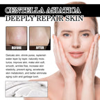 Remove Blackheads Peel Nose Mask, Deep Clean Remove Blackheads Acne And Tighten Pores Strawberry Nose Mask