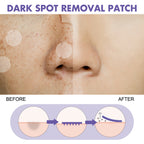 Dark Spot Removal Patch, Lightening Face Dark Spots Melasma Spots Melanin Moisturizing Whitening Skin Spot Patch