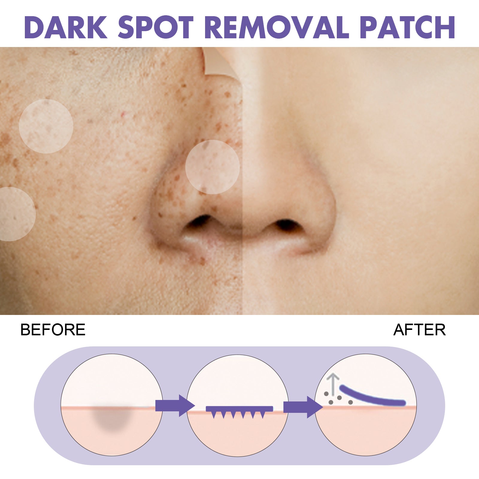 Dark Spot Removal Patch, Lightening Face Dark Spots Melasma Spots Melanin Moisturizing Whitening Skin Spot Patch