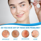 B5 Facial Essence, Lightening Spot Soft Skin Anti-aging Moisturizing Essence