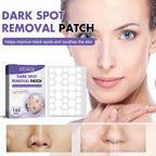 Dark Spot Removal Patch, Lightening Face Dark Spots Melasma Spots Melanin Moisturizing Whitening Skin Spot Patch
