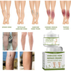 Leg Repair Cream Relieves Leg Discomfort Massage Leg Repair Cream For Raised Veins