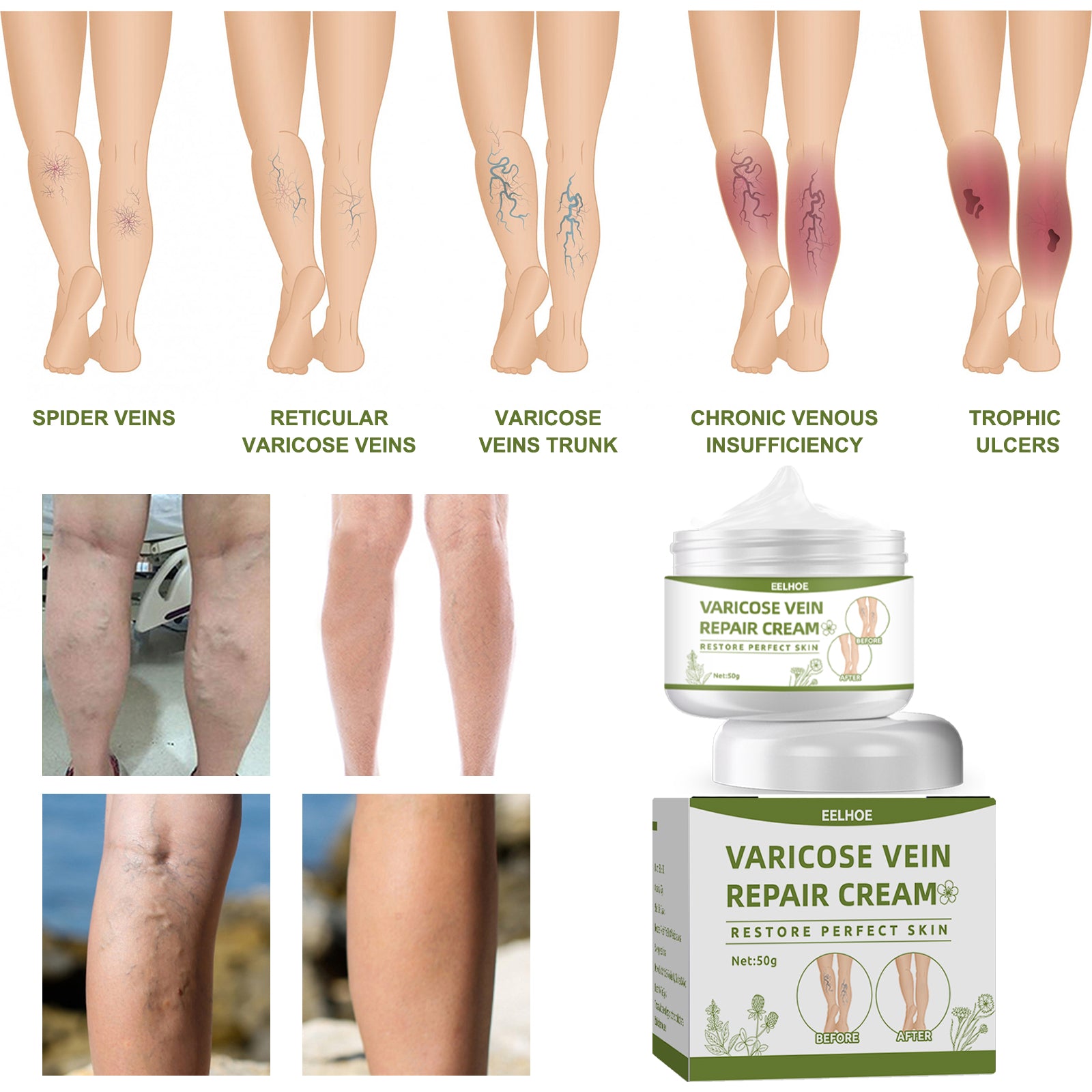 Leg Repair Cream Relieves Leg Discomfort Massage Leg Repair Cream For Raised Veins