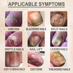 7 Day Nail Repair Essence, Hand And Foot Gray Nail Brightening Soft Nail Thickening Toenail Care Solution