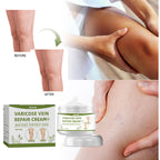 Leg Repair Cream Relieves Leg Discomfort Massage Leg Repair Cream For Raised Veins