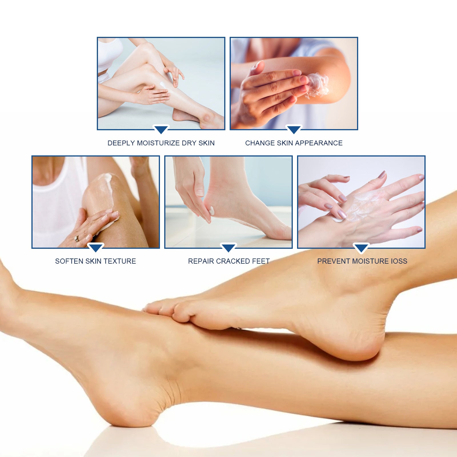 Body Repair Cream, Relieve Peeling Improve Chapped Dry Skin And Remove Dead Skin Moisturize Cream