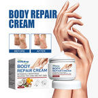 Body Repair Cream, Relieve Peeling Improve Chapped Dry Skin And Remove Dead Skin Moisturize Cream