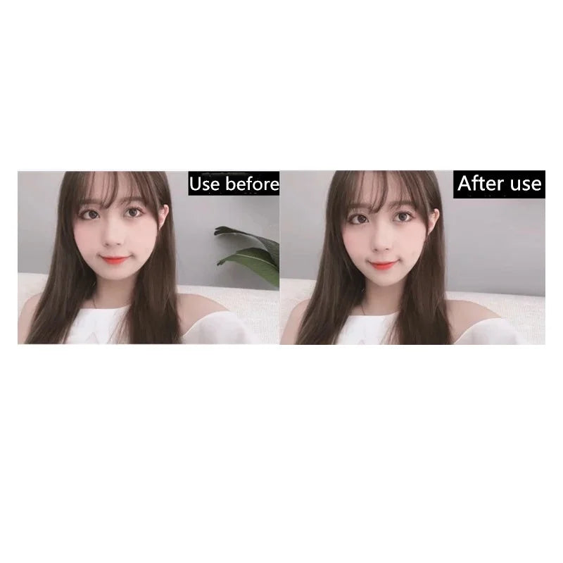 Facial Lifting Machine: Electric V - shaped Cheek Mask for Slimming, V - Line Lift & Bandage Therapy