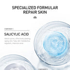 AUQUEST Salicylic Acid Acne Face Cream Pore Blackhead Removal Oil Control Niacinamide Facial Cream Skin Care