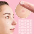 36pcs Face and Body Pimple Patches for Covering Pimples, Acne Patches or Zit Spots Stickers, Body Patches