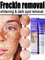Amino Acid Freckle Whitening Cream Fade Pigmentation Melasma Dark Spots Corrector Repair Cream Korean Skin Care