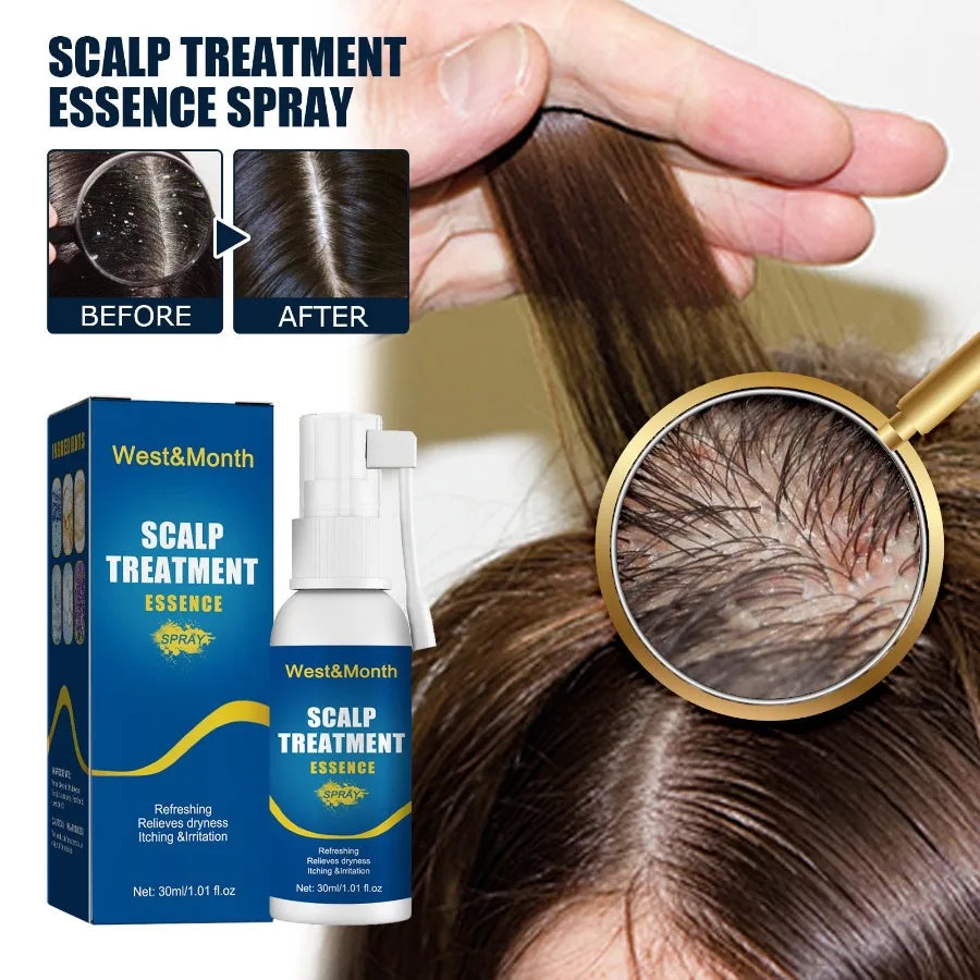 WestMonth Scalp Treatment Essence Spray Hair Care And Repair Damaged Hair Follicle Hair Root Treatment Spray