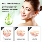 Acne Face Cream Pimple Treatment Oil Control Repair Redness Remove Blackhead Smooth Hydrating Moisturizing Pore Shrinking Serum